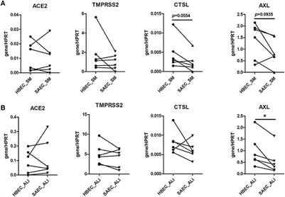 Air exposure and cell differentiation are essential for investigation of SARS-CoV-2 entry genes in human primary airway epithelial cells in vitro